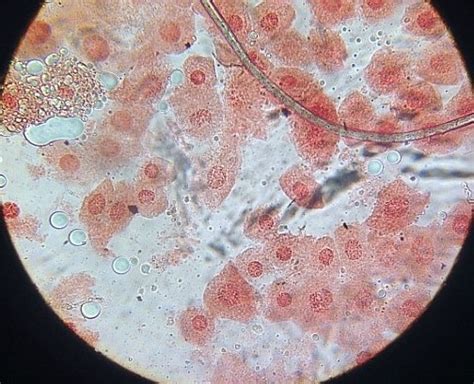 초파리 유충 침샘 염색체 관찰